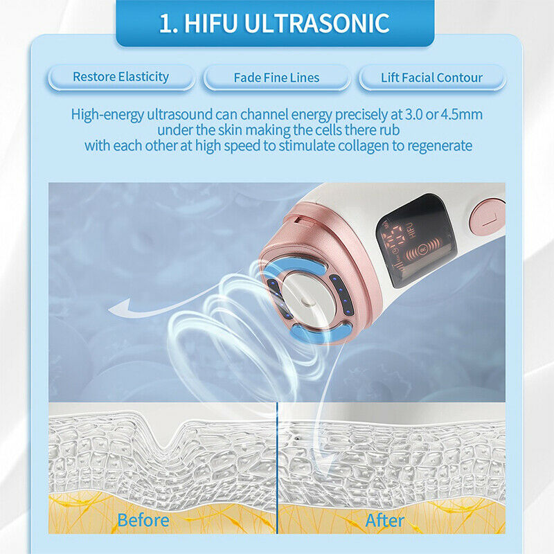 ultrasonido hifu